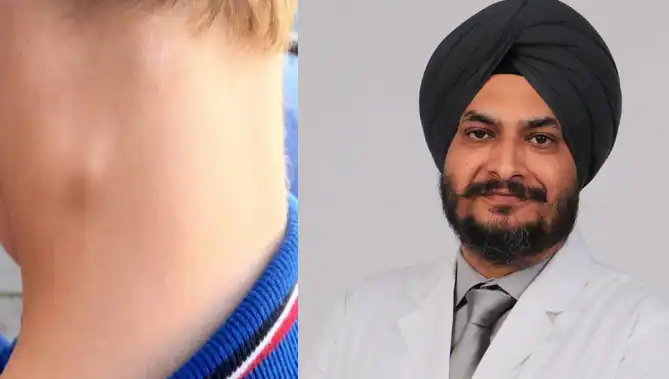 सार्कोमा का समय पर इलाज ही जीवन और अंग दोनों बचा सकता है